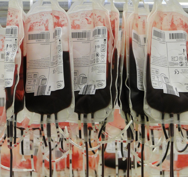 Radnice v Olomouci se změní na improvizovanou transfúzku